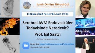 İON 229. Lecture, Saatçi: Serebral AVM Endovasküler Tedavisinde Nerdeyiz? 14.04.22