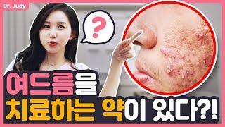 [SUB] 좁쌀 여드름이 좋아지는 약이 있다고?!* 비타민A크림 '스티바A’ 의 올바른 사용법 공개! ‍ㅣ피부좋아지는법ㅣ닥터주디 (Dr.Judy)ㅣ피부과 전문의