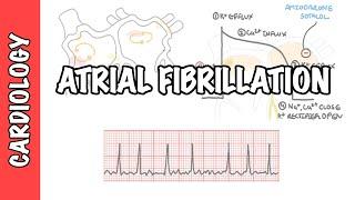 Atrial Fibrillation Overview - ECG, types, pathophysiology, treatment, complications