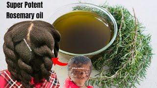 The ONLY Strongest POTENT Rosemary Oil you will ever use for x10 faster hair growth