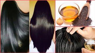 Make "ONION HAIR OIL" For Faster Hair Growth & Stop Hair Fall 100% || Magical Onion Hair Oil At Home