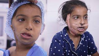 Little Girls Greatest Face Transformation  - Before & After