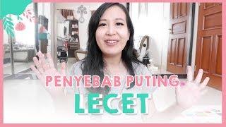 PENYEBAB PUTING LECET dan SOLUSINYA