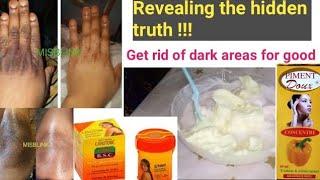 BEST way to Mix Your DARK KNUCKLES cream, dark feets, knees, elbows for a lighter skin