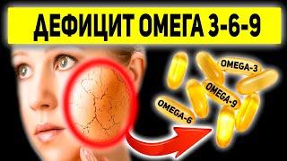 Все Симптомы Нехватки Омега-3. Отличия Омега 3-6-9. Продукты, богатые жирными кислотами