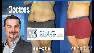 The DoctorsTV - Skin Removal after Massive Weight Loss, Matt Diaz