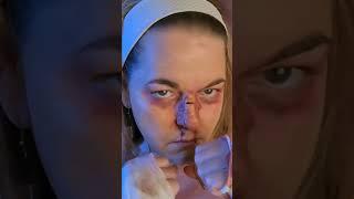 Shocking Broken Nose! SFX #shorts