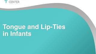 Tongue-Ties & Babies Presentation for Parents - Alabama Tongue-Tie Center