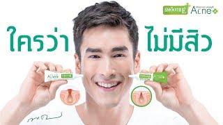 SmoothE Acne HydroGel Maximum Strength