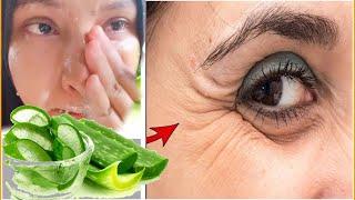 2 วิธีใช้ว่านหางจระเข้ทาหน้า ลดริ้วรอย วัย 30+ | HOW TO GET RID OF DEEP WRINKLES WITH ALOE VERA