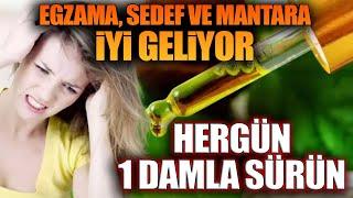 Egzama Sedef ve Mantara İyi Geliyor. HERGÜN 1 DAMLA SÜRÜN.