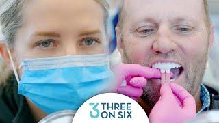 Smile Design for 3 on 6™ Dental Implant Patient