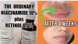 I USED THE ORDINARY  NIACINAMIDE  10% + ZINC 1%    PLUS THE ORDINARY RETINOL