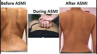 The GOODBACK Scoliosis Clinic, St Albans UK