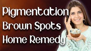 How to Get Rid of Pigmentation / Freckles / Melasma / Home Remedy  - Ghazal Siddique