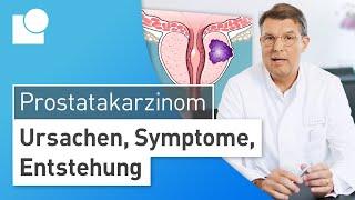 Prostatakarzinom einfach erklärt: Entstehung, Symptome & Risikofaktoren | Prostatakrebs