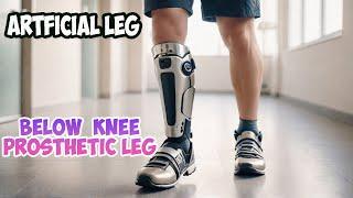 Old Man Gets Below Knee Prsothetic Leg | ARTIFICIAL LEG