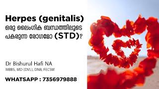 Herpes (genitalis)- ഒരു ലൈംഗിക ബന്ധത്തിലൂടെ പകരുന്ന രോഗമോ (STD)? | Dr.Bishurul Hafi