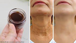 Anti aging magic oil, ️ This oil will erase all the wrinkles on your face, stronger than Botox