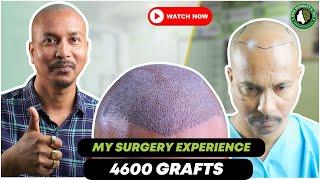 Best Hair Transplant in Guwahati | Best Hair Transplant Result & Cost in Guwahati