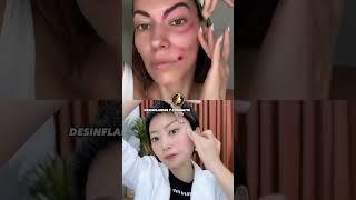 Masaje Suave en el Rostro  |  Yoga Facial