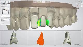 3DBioCAD - 3Shape Dental System Bridge Framework Design