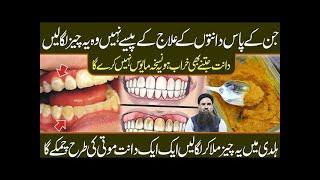 how to teeth whitening at home by Dr Sharafat Ali || Easy Teeth Whitening at Home