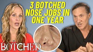 Domestic Abuse Survivor Gets A Life-Changing Rhinoplasty After 3 Botched Nose Jobs | Botched | E!