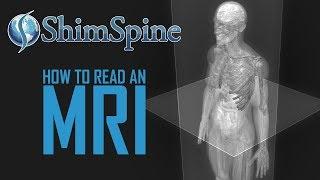 How to read an MRI