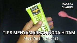 Hilangkan Flek Hitam Dengan Aloe Vera Gel & Jeruk Nipis