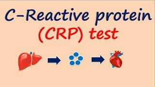 C-Reactive protein (CRP) test