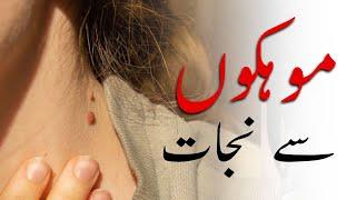 How to Rid Skin Tags and Warts - Remove Skin Tags Quickly -  Urdu Hindi