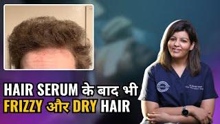 Why Your Hair Serum is Making Your Hair Frizzy? | SHOCKING TRUTH | Dadu Medical Centre