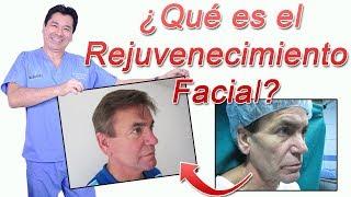 ¿Qué es el Rejuvenecimiento Facial? (Lifting Facial)