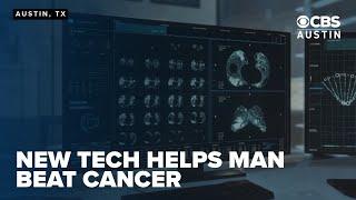 Robotic bronchoscopy helps Texas man overcome stage 4 cancer