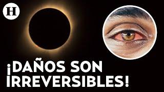 Esto le pasa a tus ojos si ves el eclipse directamente; tu retina se puede inflamar, alerta experta