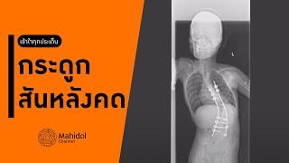 "กระดูกสันหลังคด" เกิดจากอะไร? [หาหมอ by Mahidol Channel]