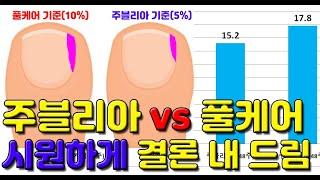 주블리아vs풀케어 누가, 얼마나 더 좋을까? 손발톱무좀 나으려면 이걸 쓰세요.