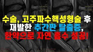 수술도 받고 고주파 수핵 성형술도 받았지만 재발한 추간판 탈출증, 한약으로 자연 흡수 성공!