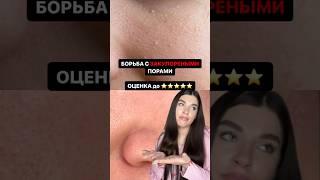 Забитые поры  #черныеточки #уходзакожей #beautyhacks #чисткалица #прыщиналице #beautytips