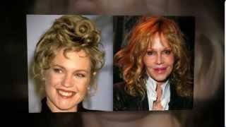 Melanie Griffith Plastic Surgery