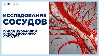 Исследование сосудов.  Какие показания к исследованию сосудов. ЦЭЛТ