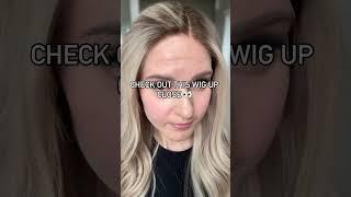 Would you guess it’s a wig?  #wigs #hairloss #thinninghair
