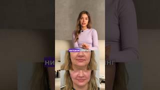 Процедуры у косметолога 30+ #косметология #ботокс #увеличениегуб