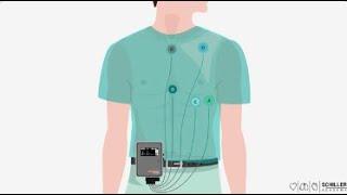 SCHILLER: l'enregistrement ambulatoire de l'ECG - Holter ECG