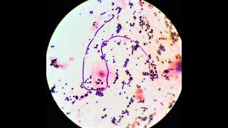 EXAM SPOTTERS | DIFFERENCE BETWEEN YEAST & GRAM POSITIVE COCCI IN A GRAM STAIN SLIDE | MICROBIOLOGY