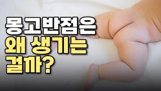 몽고반점은 왜 생기고 언제 없어지는 걸까?