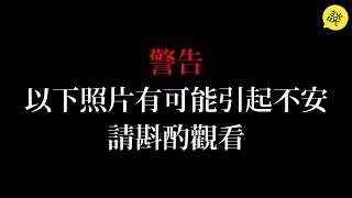 你知道這些照片背後的故事嗎？| 慎入!