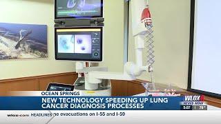 New technology at Singing River Health System’s Ocean Springs Hospital speeding up lung cancer di...