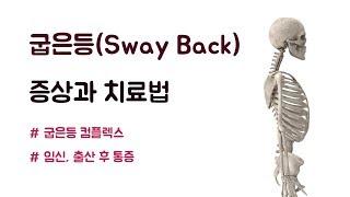 내 등이 굽은 이유? 현직의사가 알려주는 여성에게 가장 흔한 굽은등(sway back) 자세의 원인과 치료.  치중진담. 바로본신경외과 전문의 남준록 원장